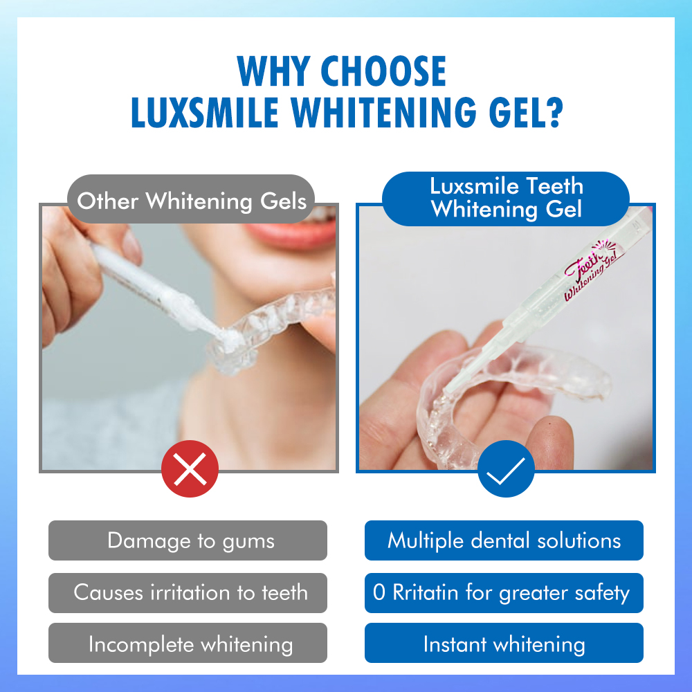 치아 미백 젤 PAP 또는 35%CP 치아 미백 젤 구 - Teeth Whitening From Home 리뷰 및 가격