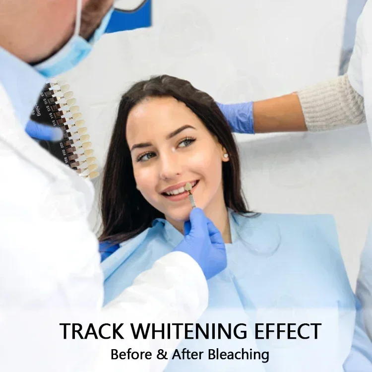 전문 치아 미백 표백 그늘 가이드/거울 구강 미용 비교 - Teeth Whitening Shade Guide 리뷰 및 가격