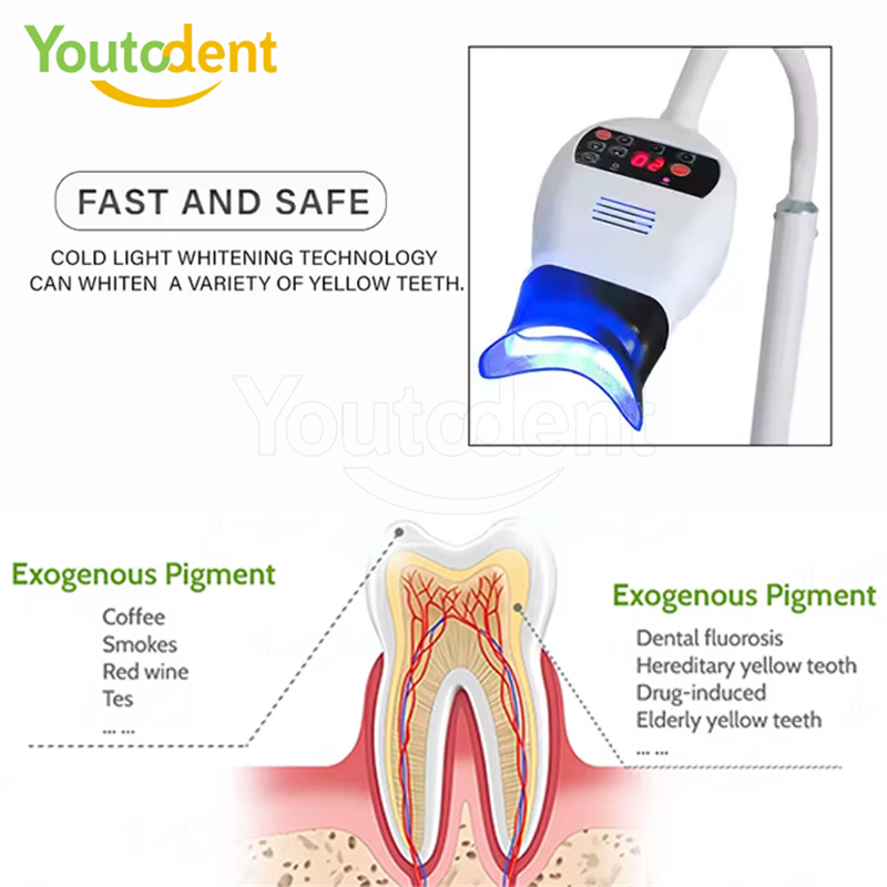 전문 치과용 3색 광 램프 치아 미백기 미백 촉진 장치 - Whitening Teeth Machine 리뷰 및 가격