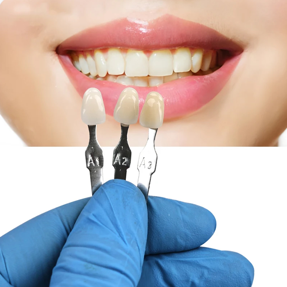 VITA 16 색 치아 쉐이드 가이드 치과 미백 연마  - Teeth Whitening Shade Guide 리뷰 및 가격
