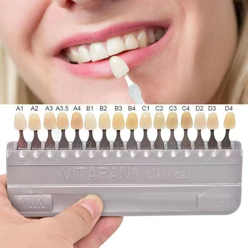VITA 16색 치아 색상표 클래식 치과용 치아 미백  - Teeth Whitening Shade Guide 리뷰 및 가격