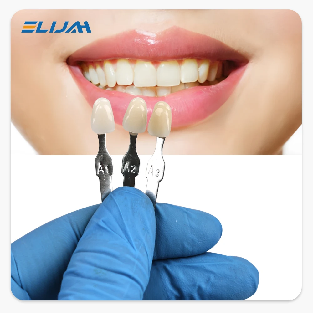 엘리야 마스터 치아 미백 색상표 16색 치아 미백 비교 - Teeth Whitening Shade Guide 리뷰 및 가격