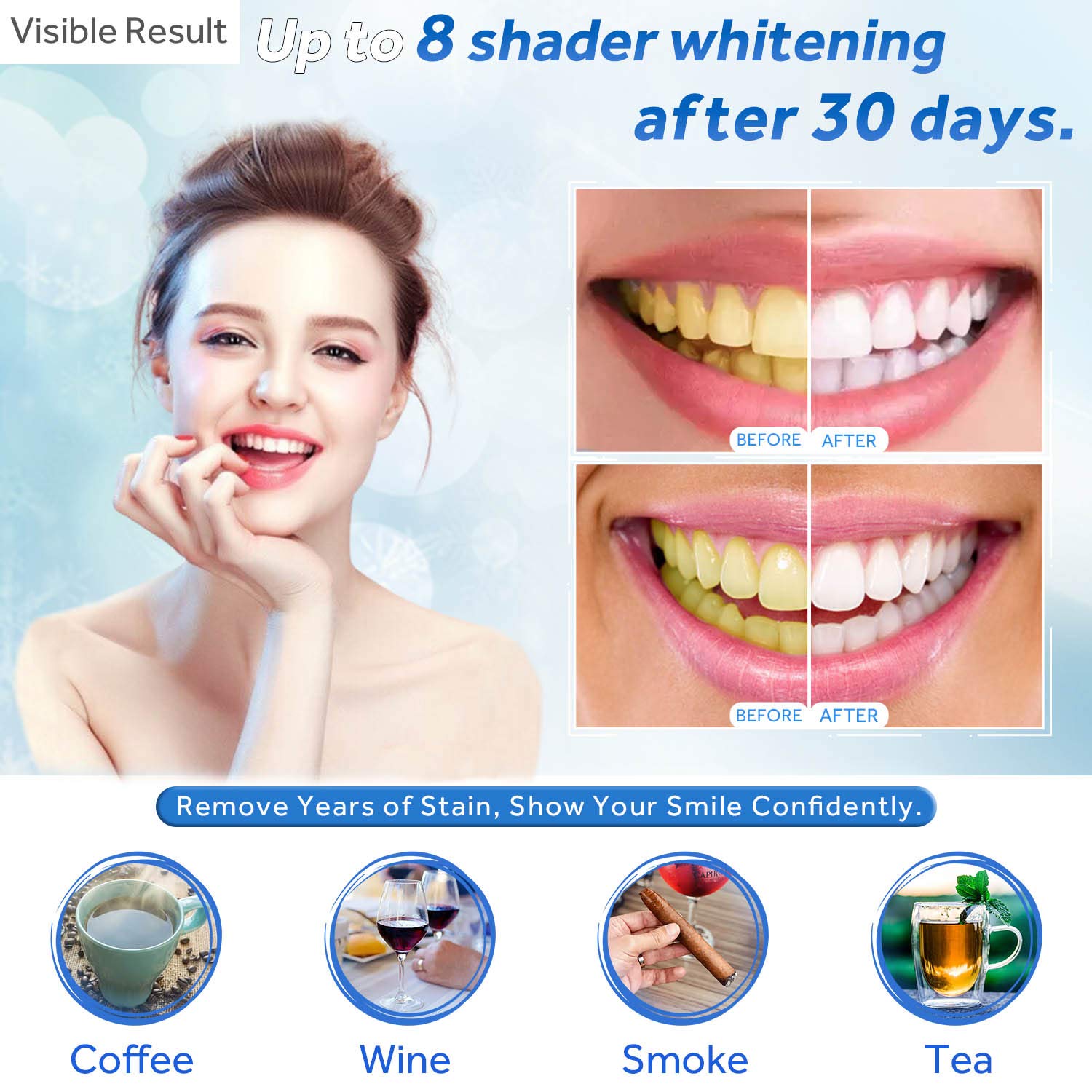 치아 미백 젤 리필 주사기 치아 미백 젤 인비스알라인  - Teeth Whitening From Home 리뷰 및 가격