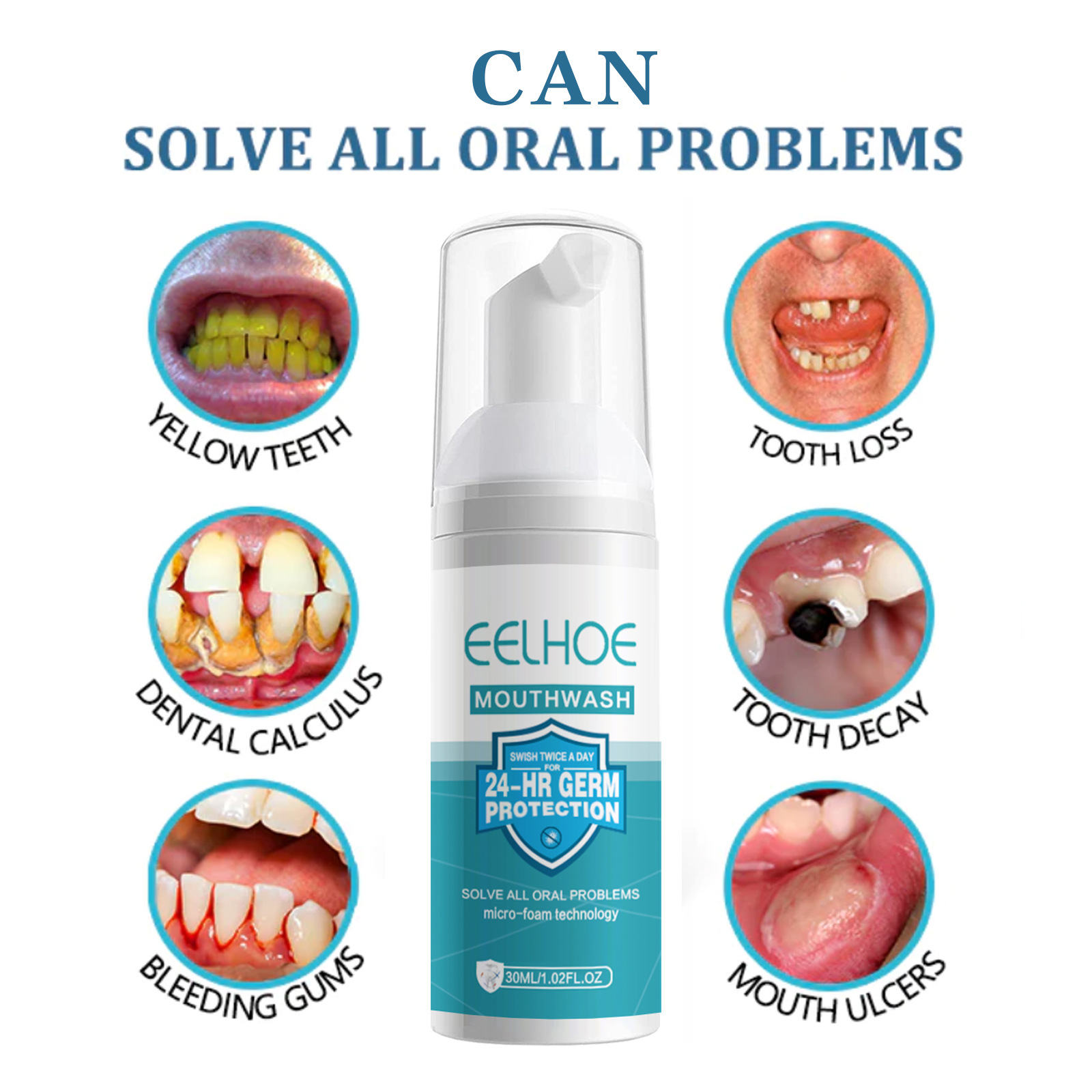EELHOE 치아 미백 청소 무스 치아 얼룩 제거 안티 - Teeth Whitening Mousse 리뷰 및 가격