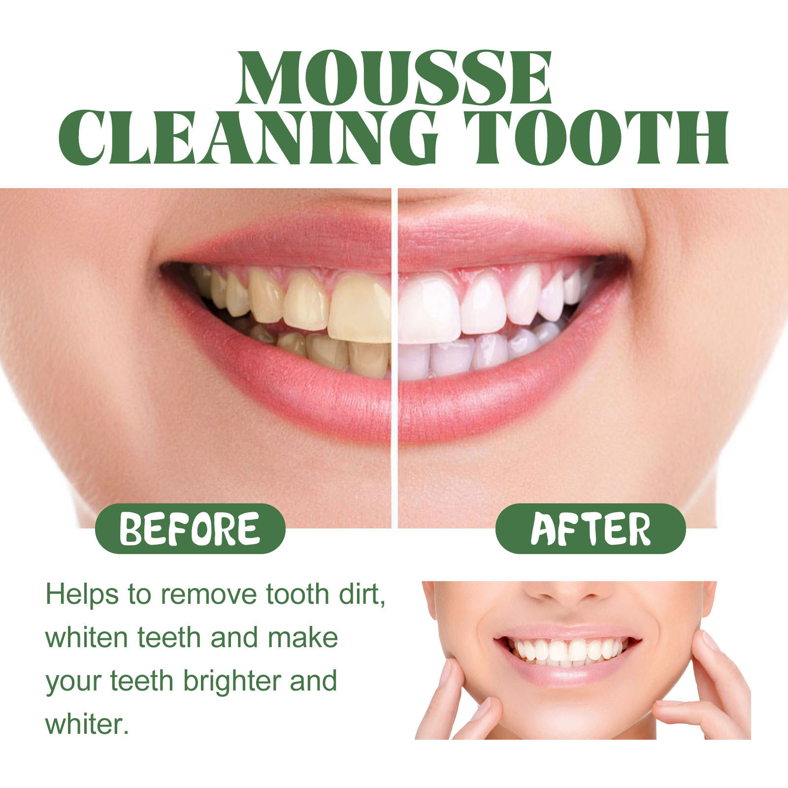 휴대용 여행용 사이즈 미백 폼 무스 치아 표면 딥 클린 - Teeth Whitening Mousse 리뷰 및 가격