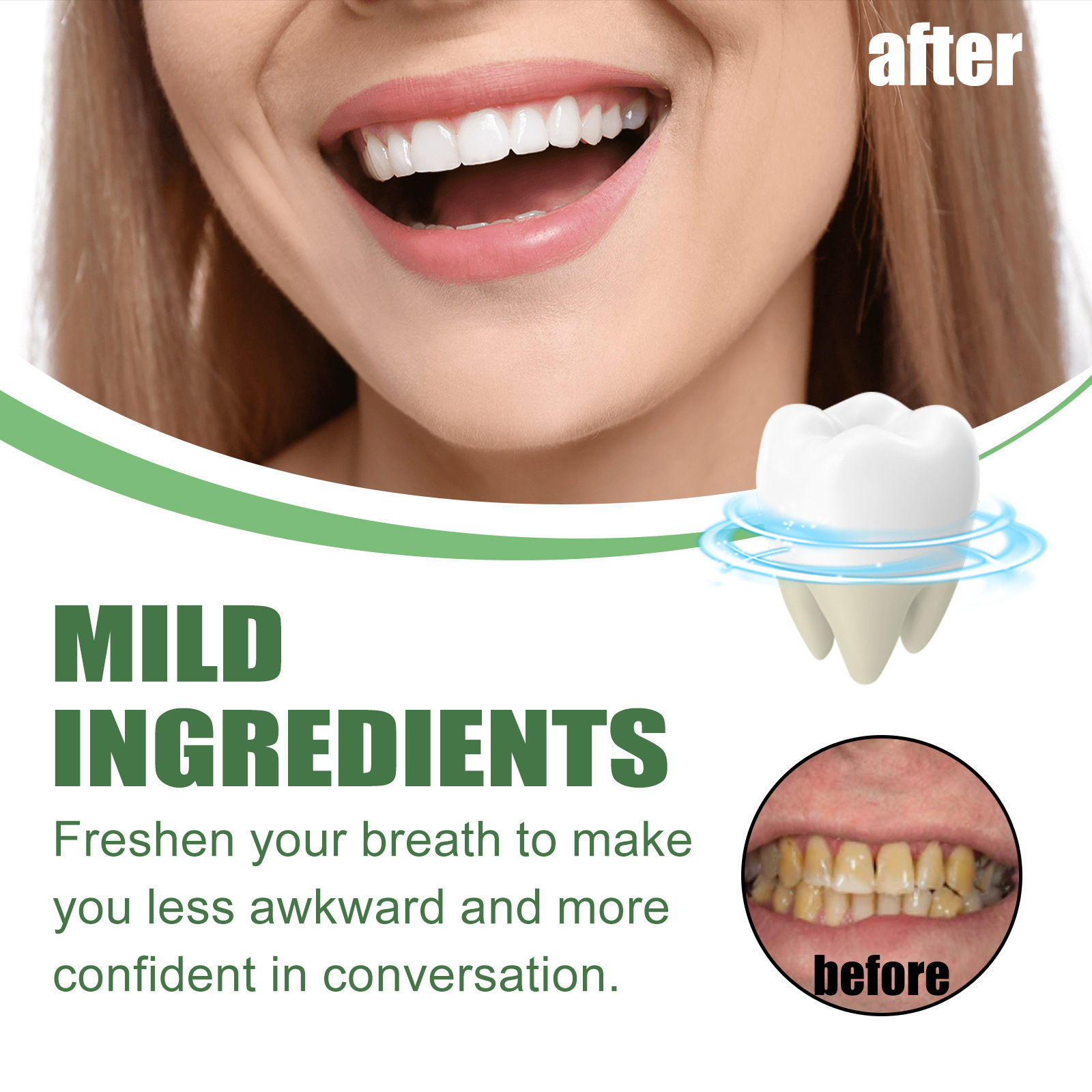 휴대용 여행용 사이즈 미백 폼 무스 치아 표면 딥 클린 - Teeth Whitening Mousse 리뷰 및 가격