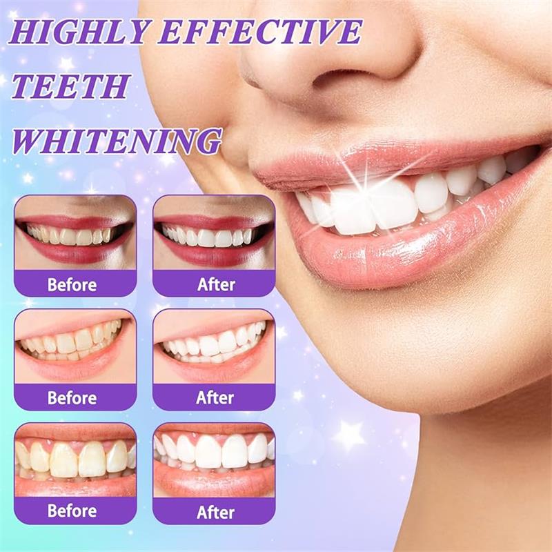 9D 퍼플 치아 미백 치약 무스, 누런 치아 및 플라그 - Teeth Whitening Mousse 리뷰 및 가격