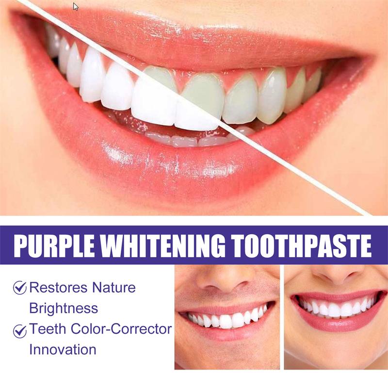 9D 퍼플 치아 미백 치약 무스, 누런 치아 및 플라그 - Teeth Whitening Mousse 리뷰 및 가격