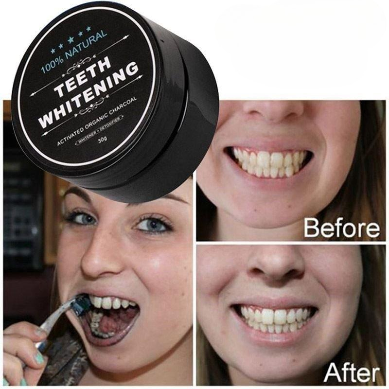 활성탄 치아 미백 파우더 1박스, 숯 치아 클리닝 파우 - Whitening Powder Activated 리뷰 및 가격