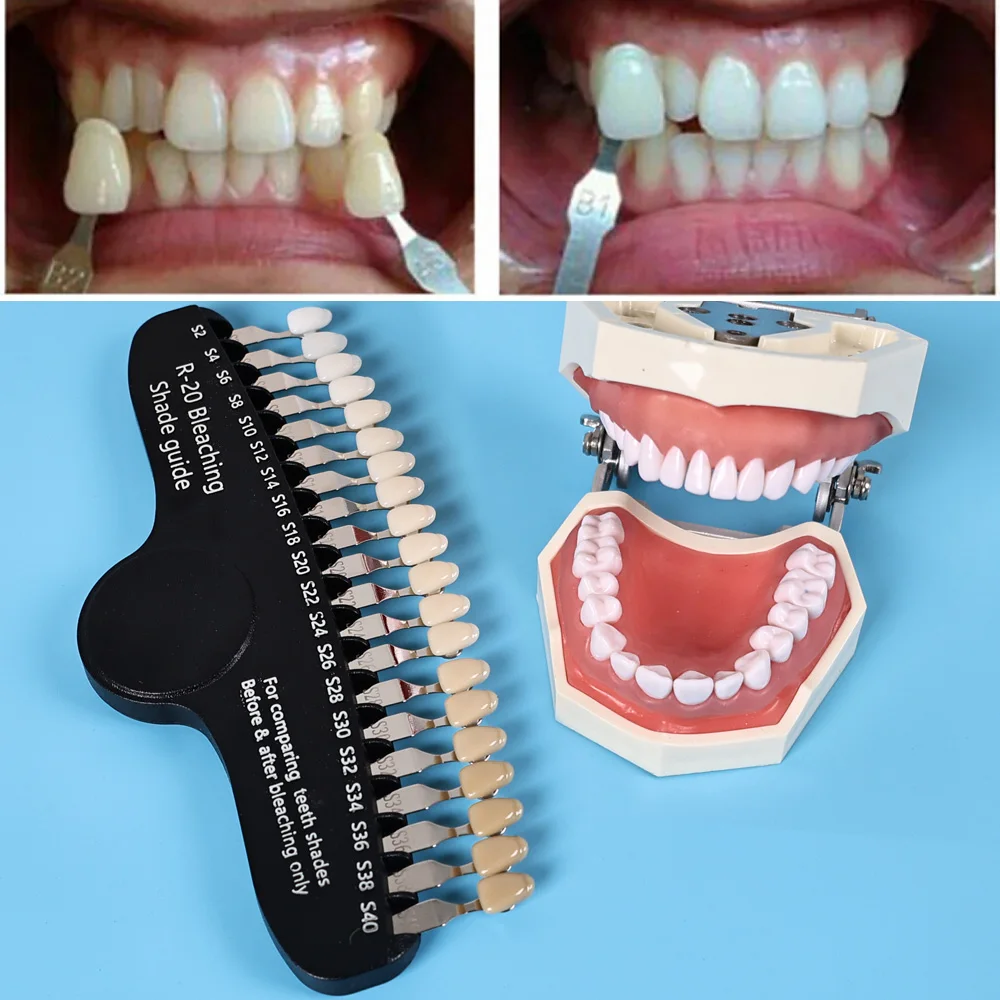 엘리야 R-20 표백 그림자 가이드 치과 20 색상 3 - Teeth Whitening Shade Guide 리뷰 및 가격