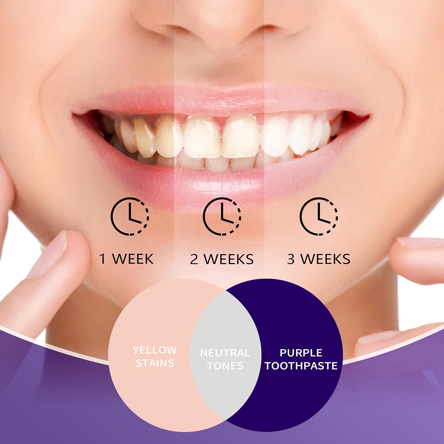 치아 미백용 퍼플 치약, 색상 보정 미백 치약, 누런  - Teeth Whitening Mousse 리뷰 및 가격