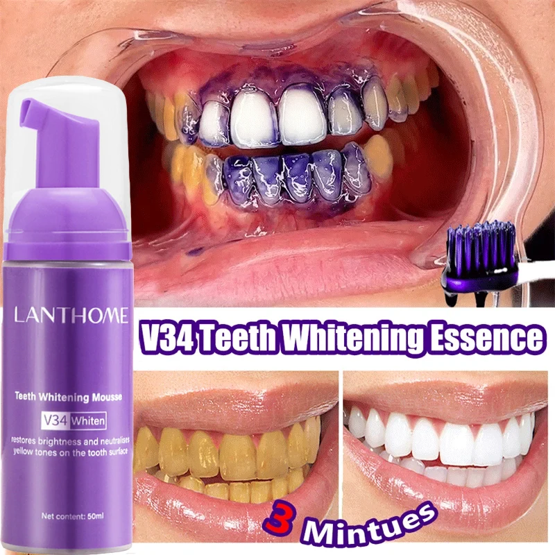 V34 치아 미백 무스 치약 플라그 제거 얼룩 제거 구 - Teeth Whitening Mousse 리뷰 및 가격