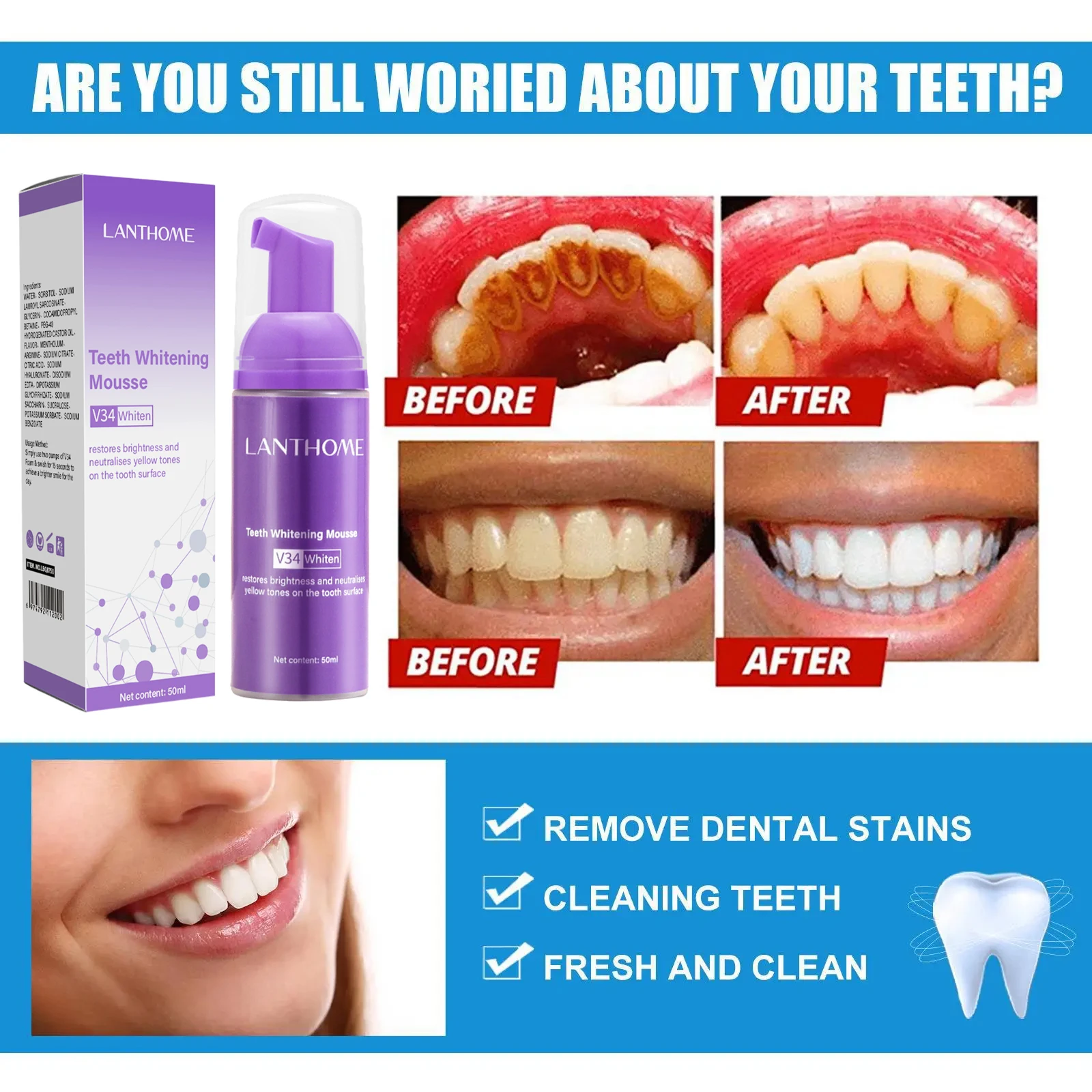 V34 치아 미백 무스 치약 플라그 제거 얼룩 제거 구 - Teeth Whitening Mousse 리뷰 및 가격