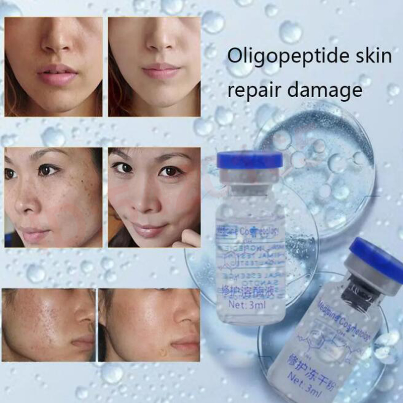 액티브 유닛 EGF 리페어 동결 건조 파우더 8만 여분 - Whitening Powder Activated 리뷰 및 가격
